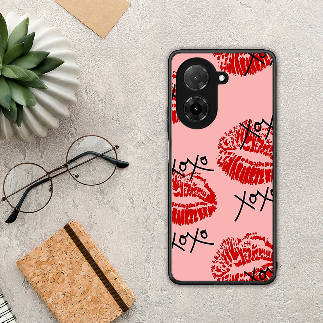 XOXO Lips - Xiaomi Redmi A5 θήκη