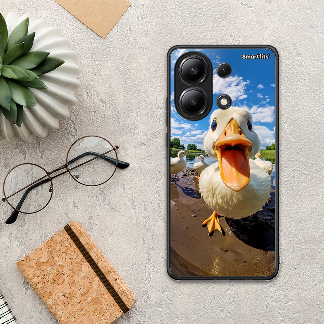 Duck Face - Xiaomi Redmi Note 13 4G θήκη