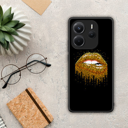 Valentine Golden - Xiaomi Redmi Note 14 4G θήκη