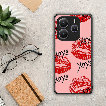 XOXO Lips - Xiaomi Redmi Note 14 5G θήκη