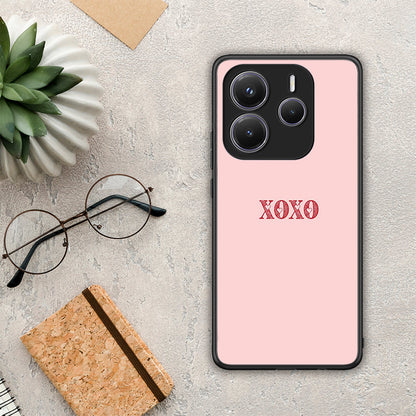 XOXO Love - Xiaomi Redmi Note 14 5G θήκη