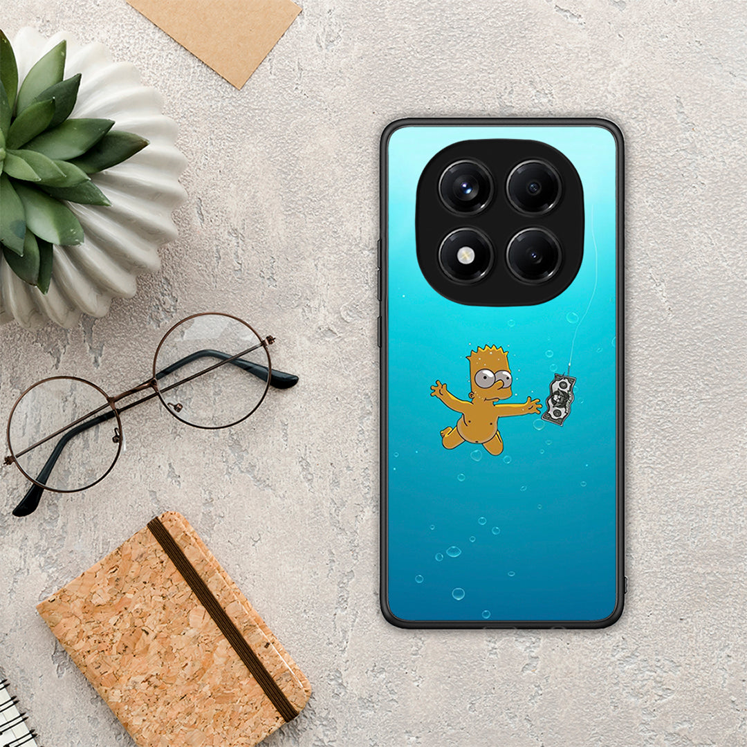 Chasing Money - Xiaomi Redmi Note 14 Pro 4G θήκη