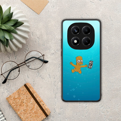 Chasing Money - Xiaomi Redmi Note 14 Pro 4G θήκη