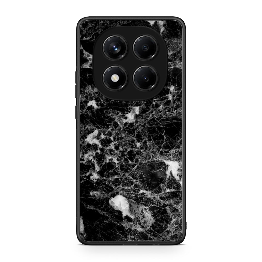 3 - Xiaomi Redmi Note 14 Pro 4G Male marble case, cover, bumper