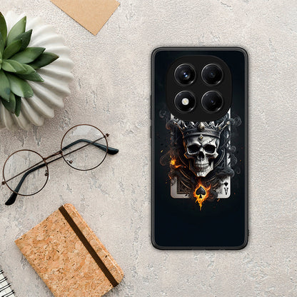 Skull King Ace - Xiaomi Redmi Note 14 Pro 4G θήκη