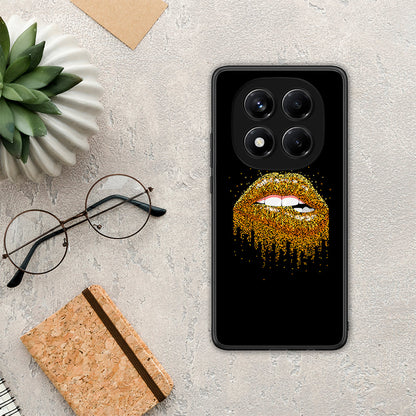 Valentine Golden - Xiaomi Redmi Note 14 Pro 4G θήκη