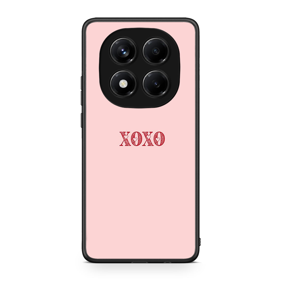 Xiaomi Redmi Note 14 Pro 4G XOXO Love θήκη από τη Smartfits με σχέδιο στο πίσω μέρος και μαύρο περίβλημα | Smartphone case with colorful back and black bezels by Smartfits