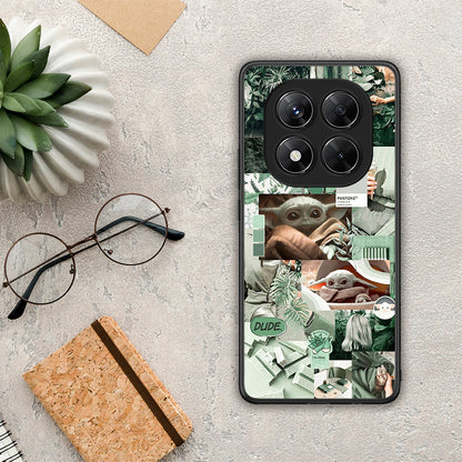 Collage Dude - Xiaomi Redmi Note 14 Pro 5G / Poco X7 θήκη