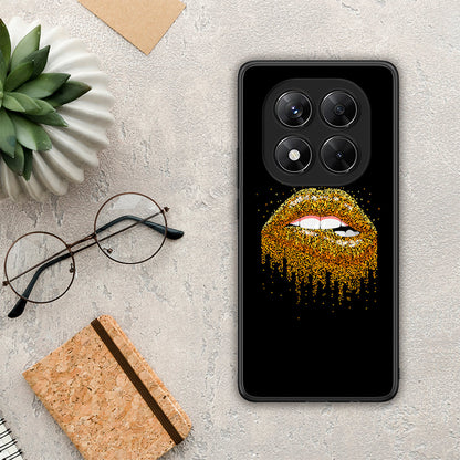 Valentine Golden - Xiaomi Redmi Note 14 Pro 5G / Poco X7 θήκη