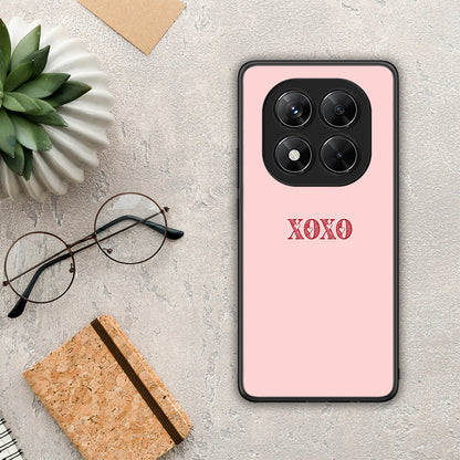 XOXO Love - Xiaomi Redmi Note 14 Pro 5G / Poco X7 θήκη