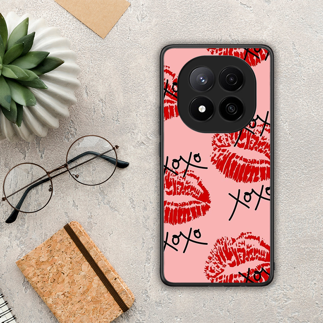 XOXO Lips - Xiaomi Redmi Note 14 Pro Plus 5G θήκη