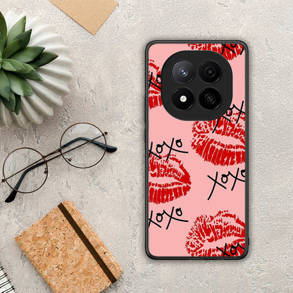 XOXO Lips - Xiaomi Redmi Note 14 Pro Plus 5G θήκη