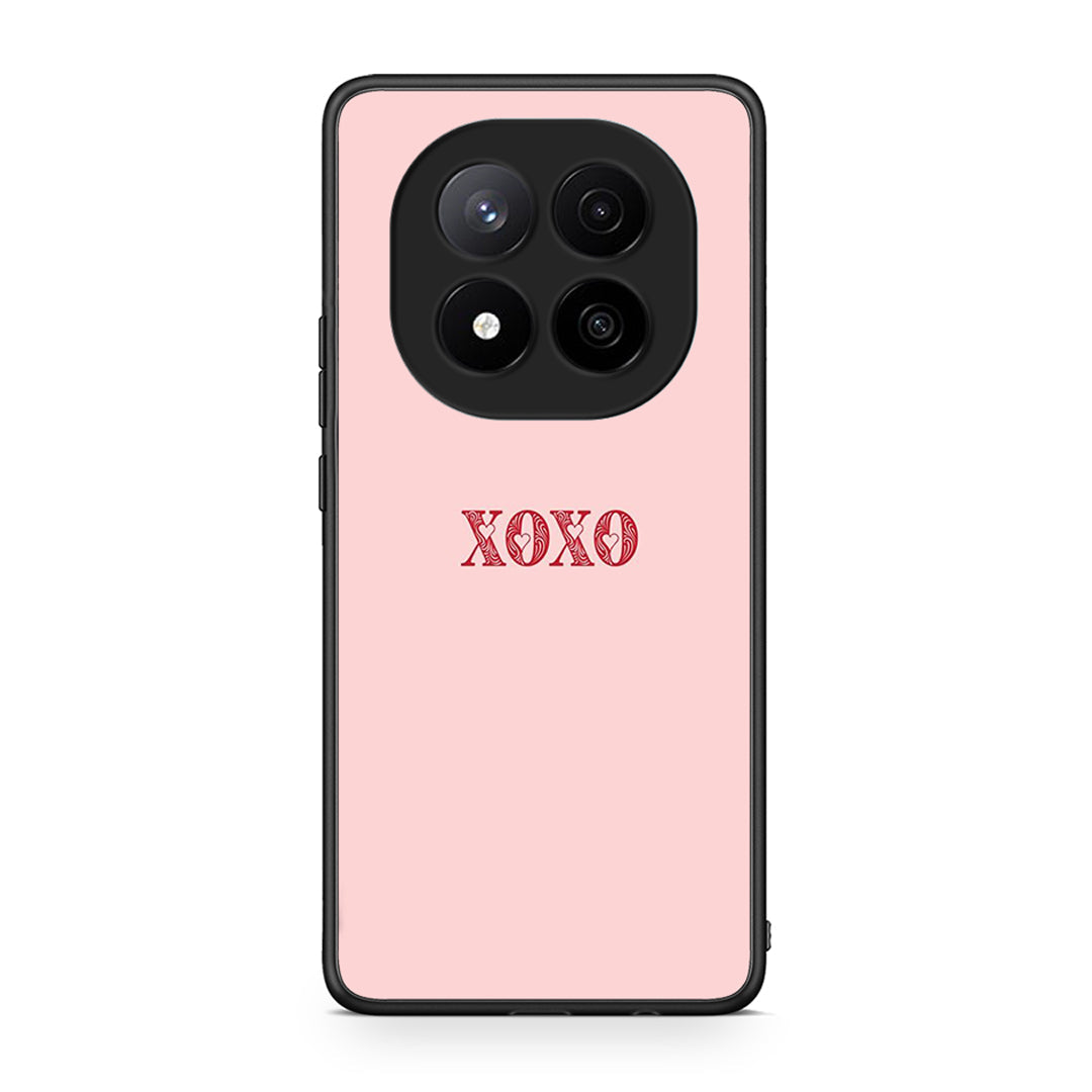 Xiaomi Redmi Note 14 Pro Plus 5G XOXO Love θήκη από τη Smartfits με σχέδιο στο πίσω μέρος και μαύρο περίβλημα | Smartphone case with colorful back and black bezels by Smartfits