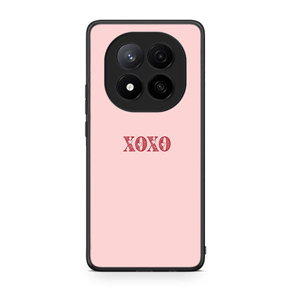 Xiaomi Redmi Note 14 Pro Plus 5G XOXO Love θήκη από τη Smartfits με σχέδιο στο πίσω μέρος και μαύρο περίβλημα | Smartphone case with colorful back and black bezels by Smartfits