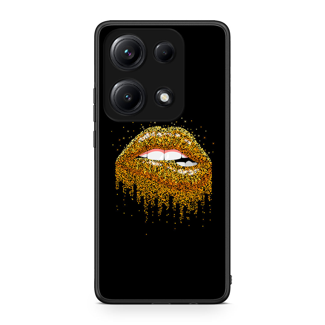 4 - Xiaomi Redmi Note 14S Golden Valentine case, cover, bumper