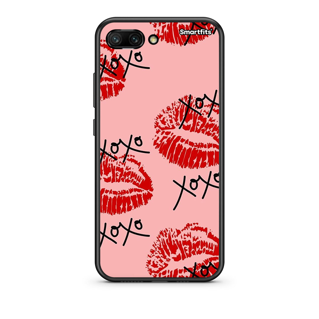 XOXO Lips - Honor 10 θήκη