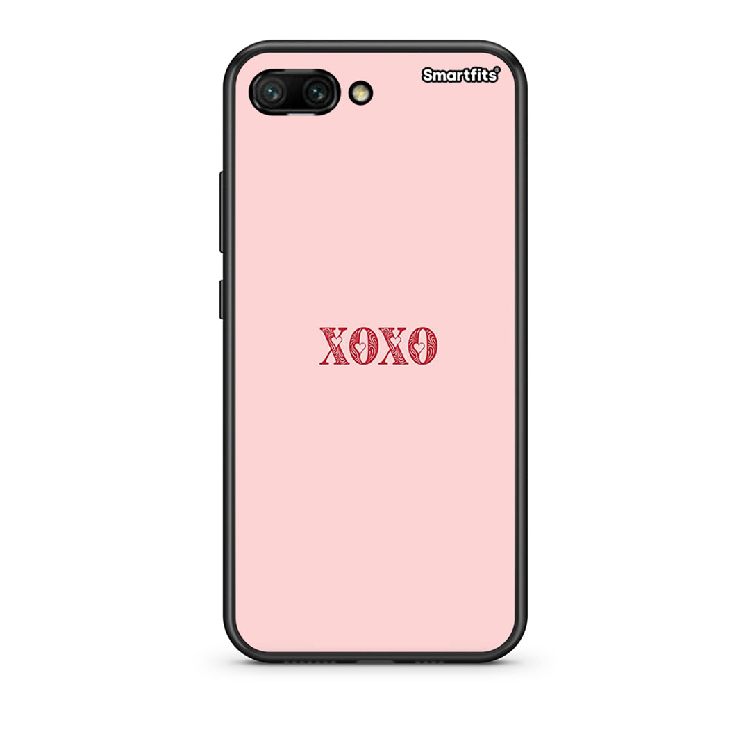 XOXO Love - Honor 10 θήκη