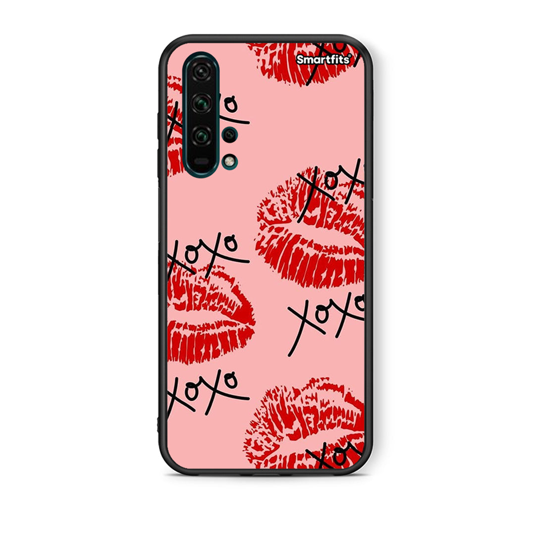 XOXO Lips - Honor 20 Pro θήκη