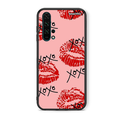 XOXO Lips - Honor 20 Pro θήκη