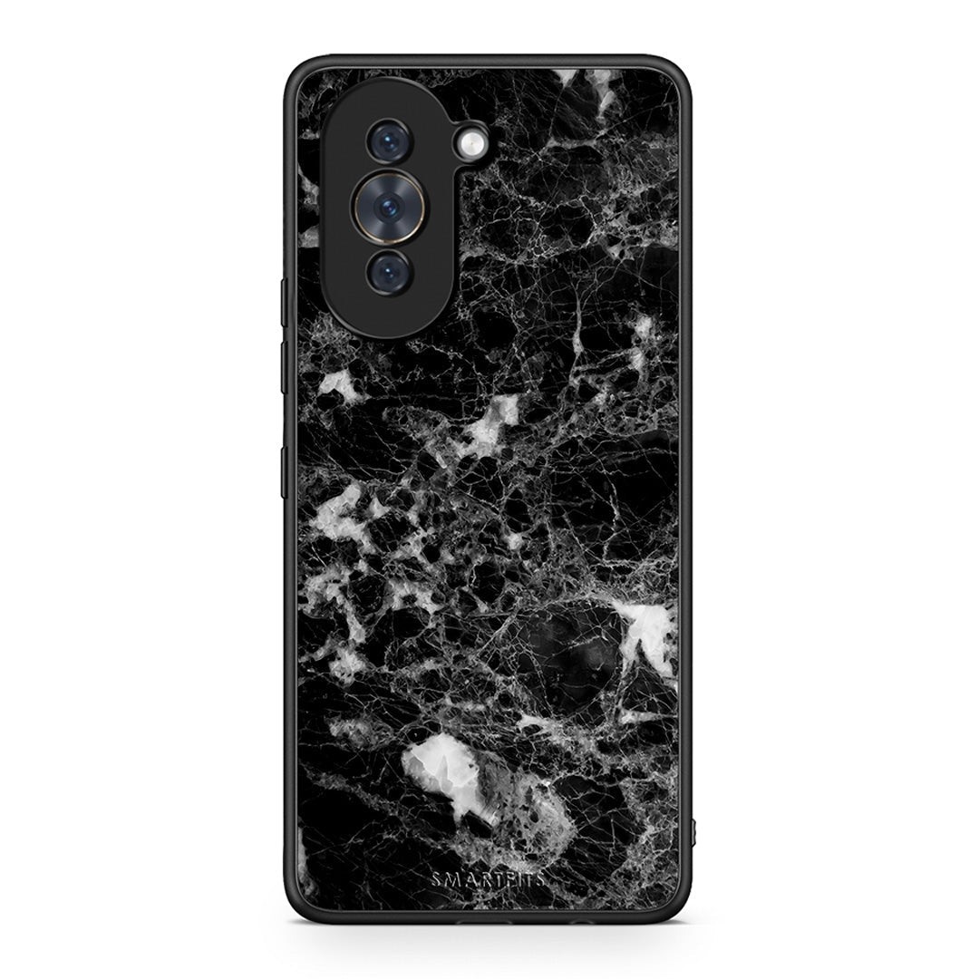 3 - Huawei Nova 10 Male marble case, cover, bumper