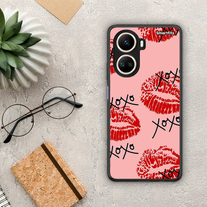 Θήκη Huawei Nova 10 SE XOXO Lips από τη Smartfits με σχέδιο στο πίσω μέρος και μαύρο περίβλημα | Huawei Nova 10 SE XOXO Lips Case with Colorful Back and Black Bezels