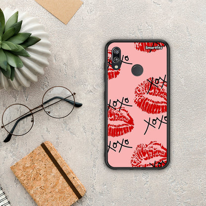 XOXO Lips - Huawei P20 Lite θήκη