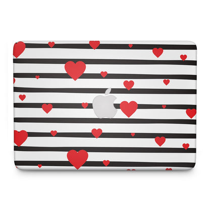 Valentine Stripes - Macbook Skin