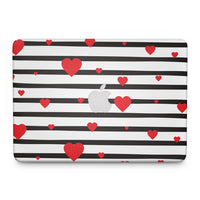 Thumbnail for Valentine Stripes - Macbook Skin