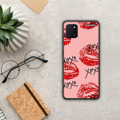 XOXO Lips - Samsung Galaxy Note 10 Lite θήκη
