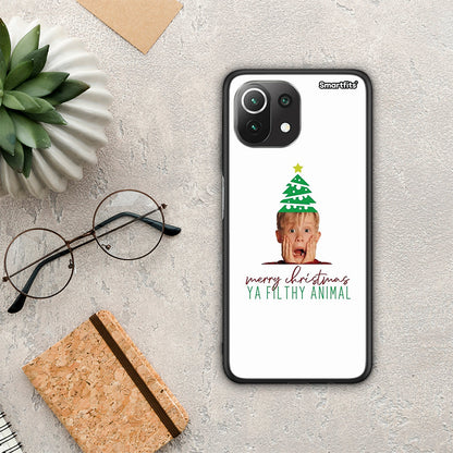 Filthy Animal - Xiaomi 11 Lite 5G NE / Mi 11 Lite θήκη