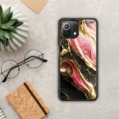 Glamorous Pink Marble - Xiaomi 11 Lite 5G NE / Mi 11 Lite θήκη