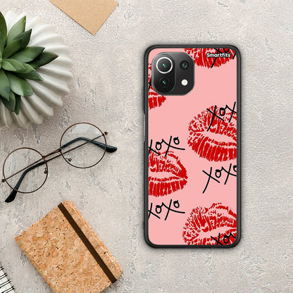 XOXO Lips - Xiaomi 11 Lite 5G NE / Mi 11 Lite θήκη