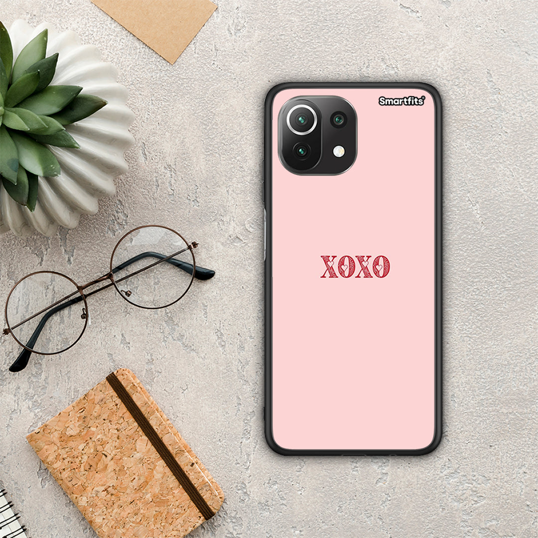 XOXO Love - Xiaomi 11 Lite 5G NE / Mi 11 Lite θήκη
