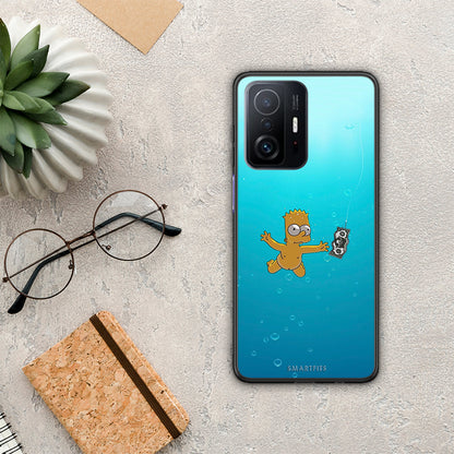 Chasing Money - Xiaomi 11T / 11T Pro θήκη