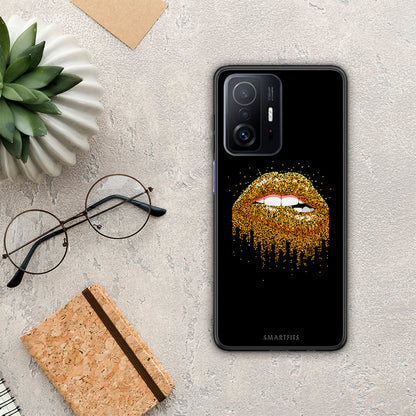 Valentine Golden - Xiaomi 11T / 11T Pro θήκη