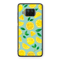 Thumbnail for Θήκη Xiaomi Mi 10T Lite Lemons από τη Smartfits με σχέδιο στο πίσω μέρος και μαύρο περίβλημα | Xiaomi Mi 10T Lite Lemons case with colorful back and black bezels