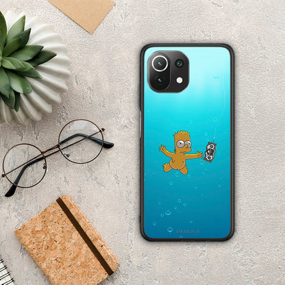 Chasing Money - Xiaomi 11 Lite 5G NE / Mi 11 Lite θήκη