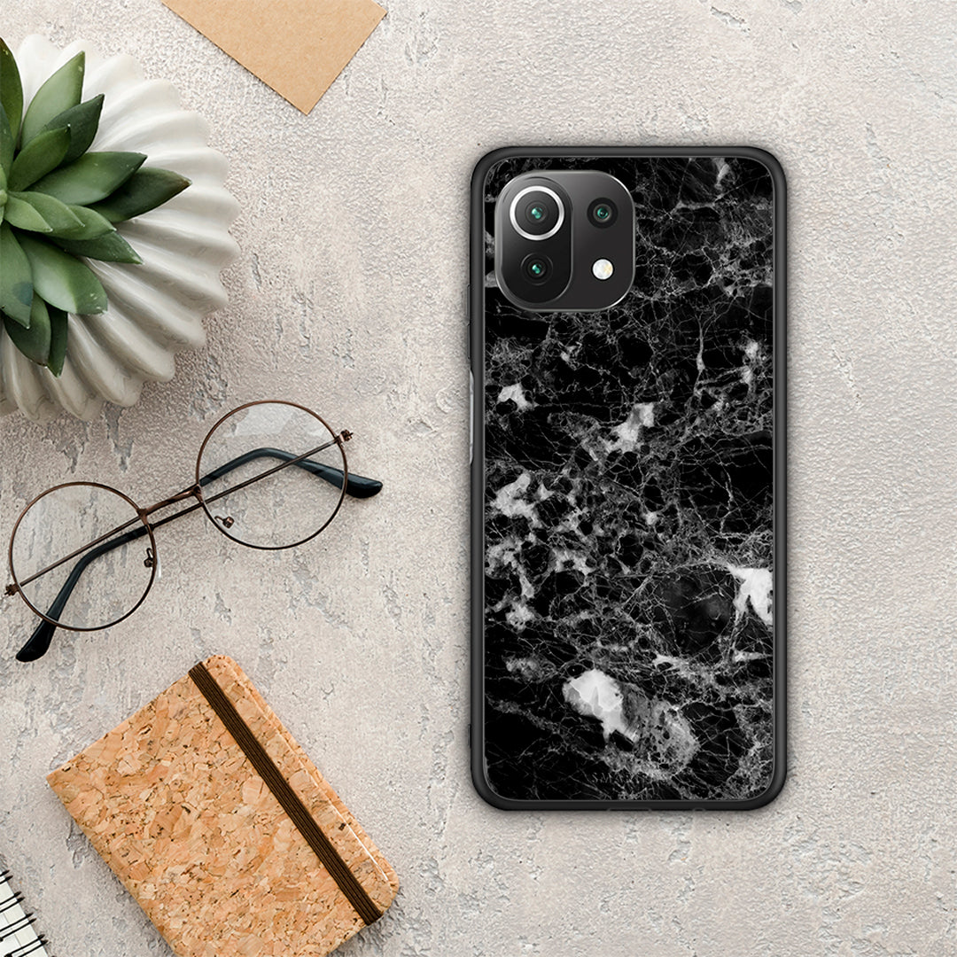 Marble Male - Xiaomi 11 Lite 5G NE / Mi 11 Lite θήκη