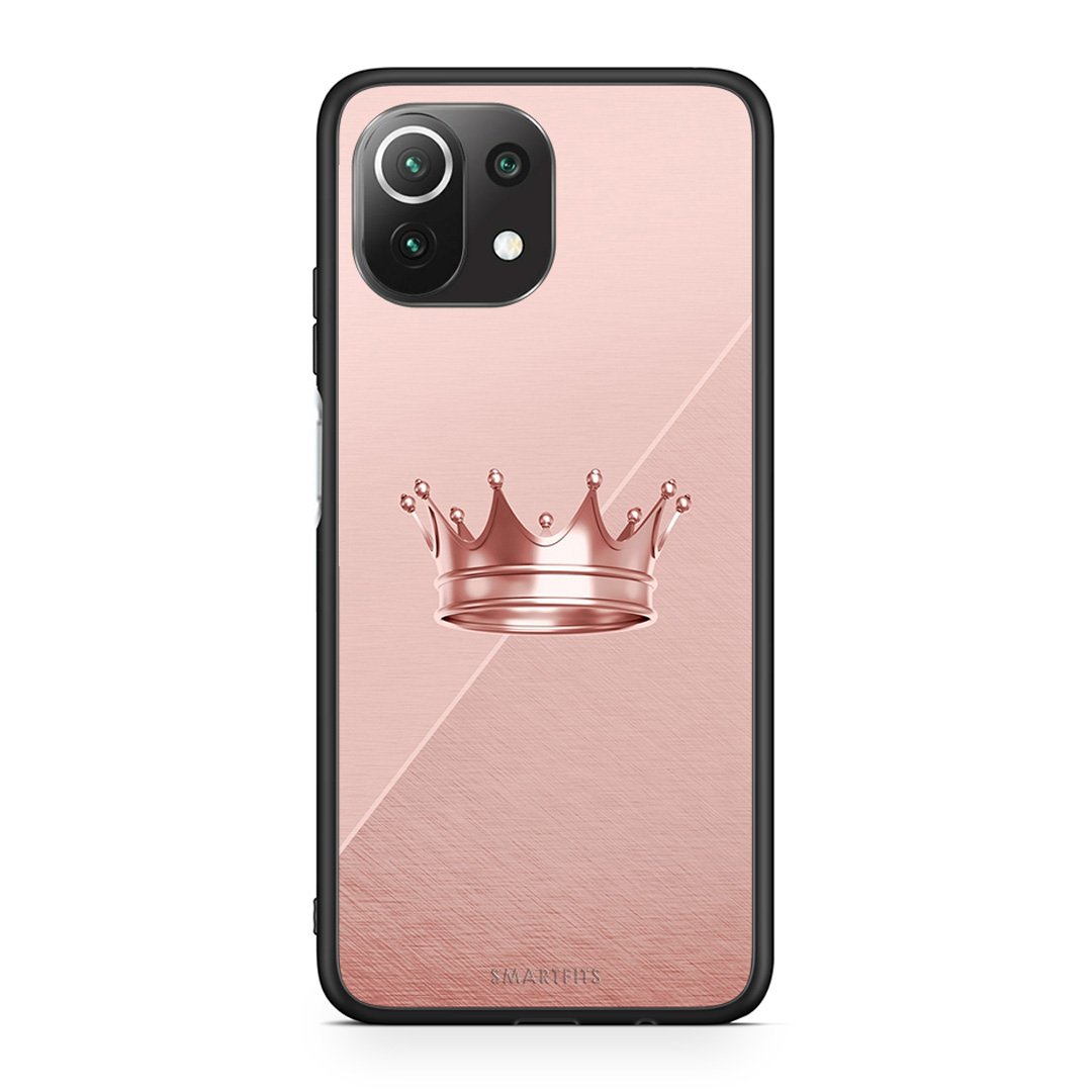 4 - Xiaomi 11 Lite/Mi 11 Lite Crown Minimal case, cover, bumper