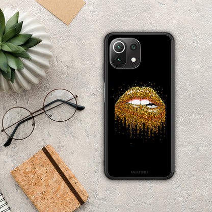 Valentine Golden - Xiaomi 11 Lite 5G NE / Mi 11 Lite θήκη