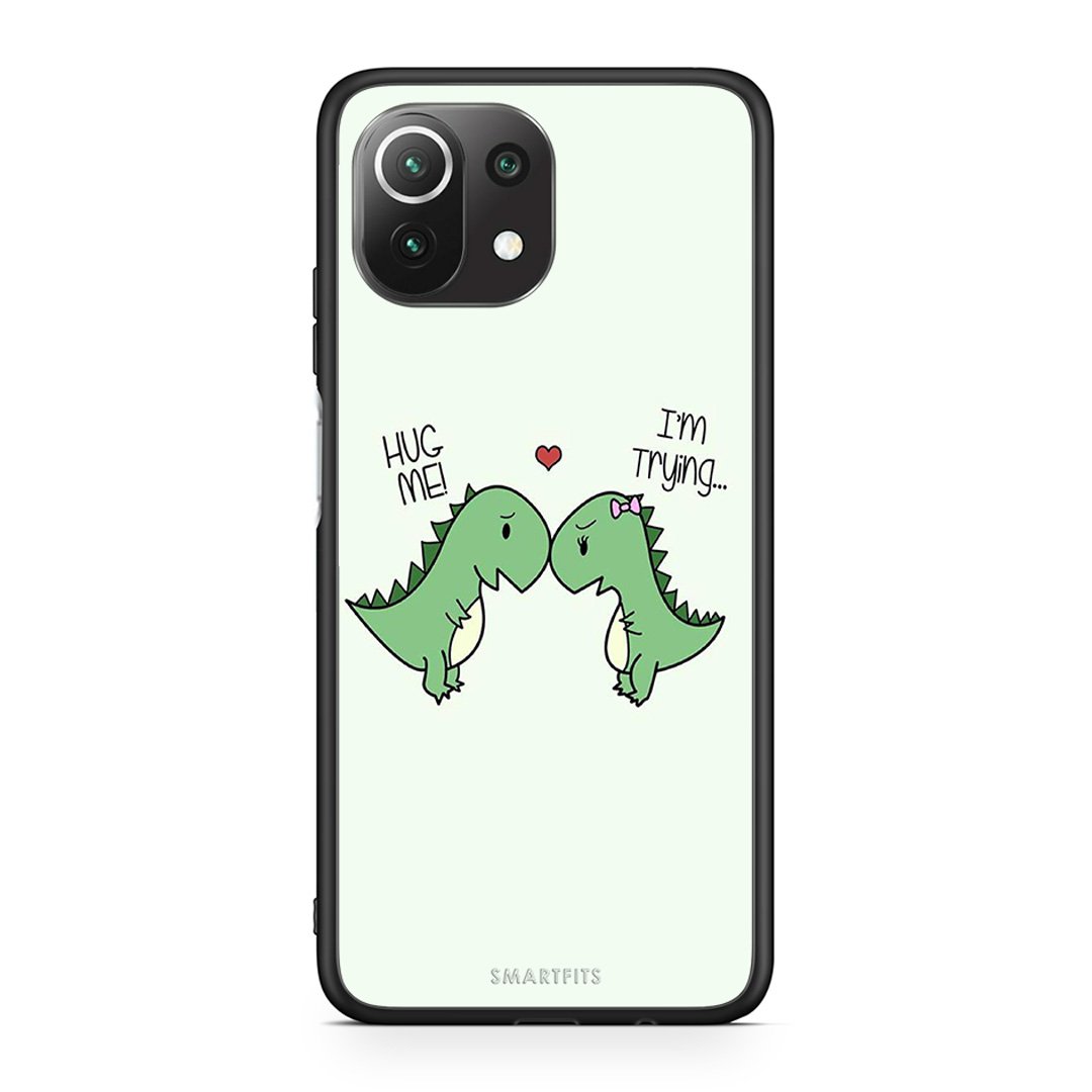 4 - Xiaomi 11 Lite/Mi 11 Lite Rex Valentine case, cover, bumper