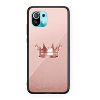 Thumbnail for 4 - Xiaomi Mi 11 Crown Minimal case, cover, bumper