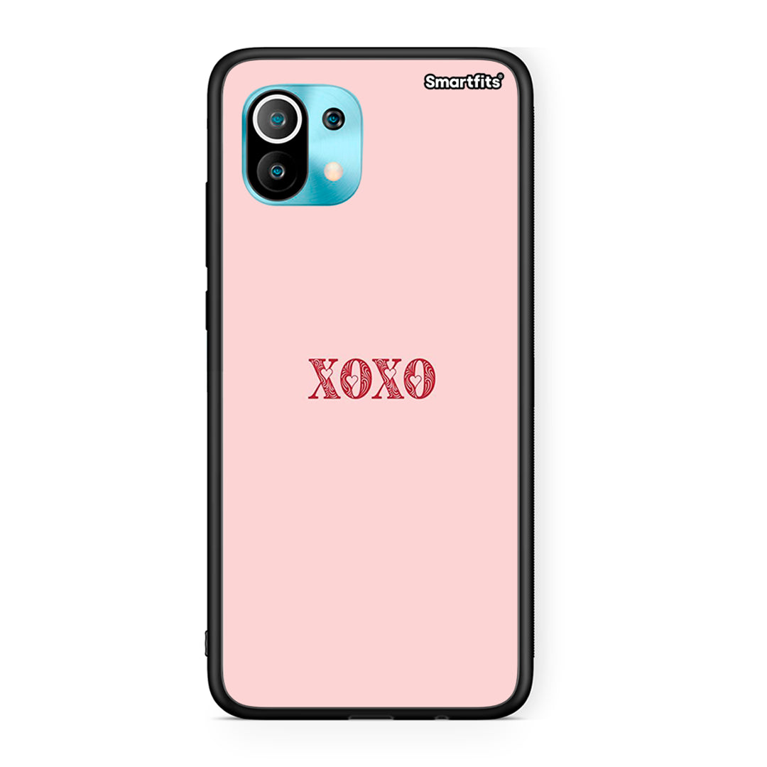 Xiaomi Mi 11 XOXO Love θήκη από τη Smartfits με σχέδιο στο πίσω μέρος και μαύρο περίβλημα | Smartphone case with colorful back and black bezels by Smartfits