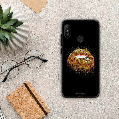 Valentine Golden - Xiaomi Mi A2 Lite θήκη