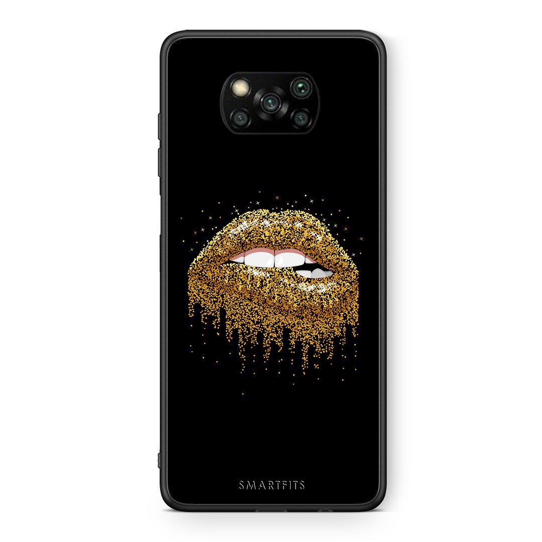 Θήκη Xiaomi Poco X3 Golden Valentine από τη Smartfits με σχέδιο στο πίσω μέρος και μαύρο περίβλημα | Xiaomi Poco X3 Golden Valentine case with colorful back and black bezels