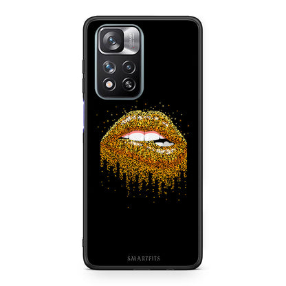 4 - Xiaomi Redmi Note 11 Pro/11 Pro+ Golden Valentine case, cover, bumper