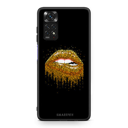 4 - Xiaomi Redmi Note 11 Golden Valentine case, cover, bumper