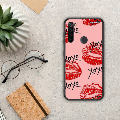 XOXO Lips - Xiaomi Redmi Note 8T θήκη